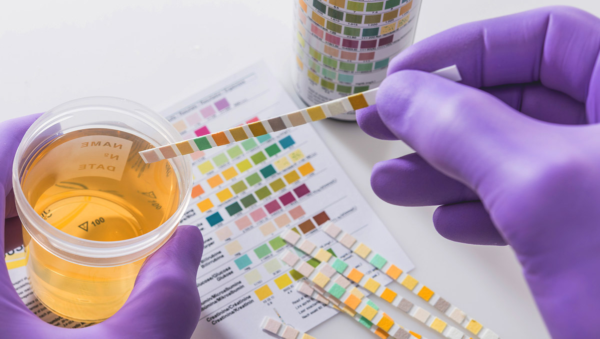 Drug test results will vary when using cannabis transdermals or topicals. Drug test results will vary when using cannabis transdermals or topicals.