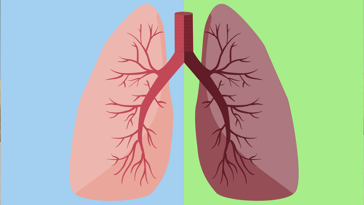 Lungs' health differences between smoking and vaping