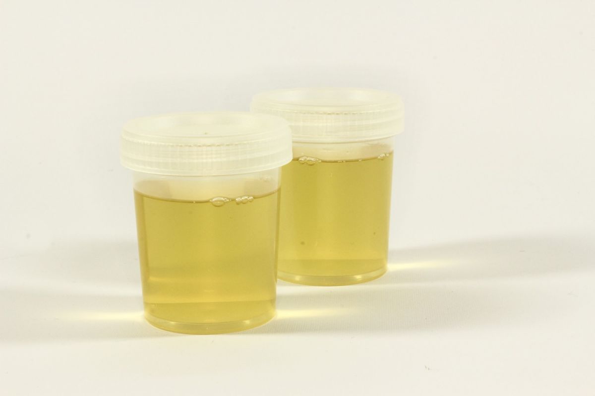 urine test.jpg urine test