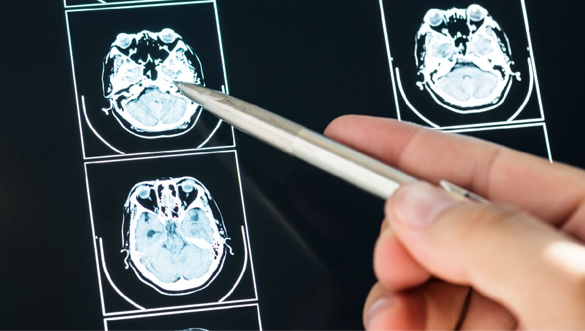 Does Marijuana Boost Brain Power or Harm It? A person's hand as they show something on a brain scan, pointing it with a pen Does Marijuana Boost Brain Power or Harm It? A person's hand as they show something on a brain scan, pointing it with a pen